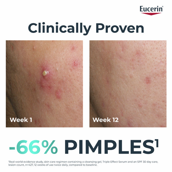 Eucerin Dermopurifyer Triple Effect Serum 40ml